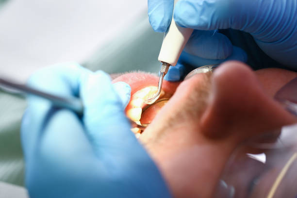 Best Tooth Infection Emergency Dentist  in Riverdale, CA
